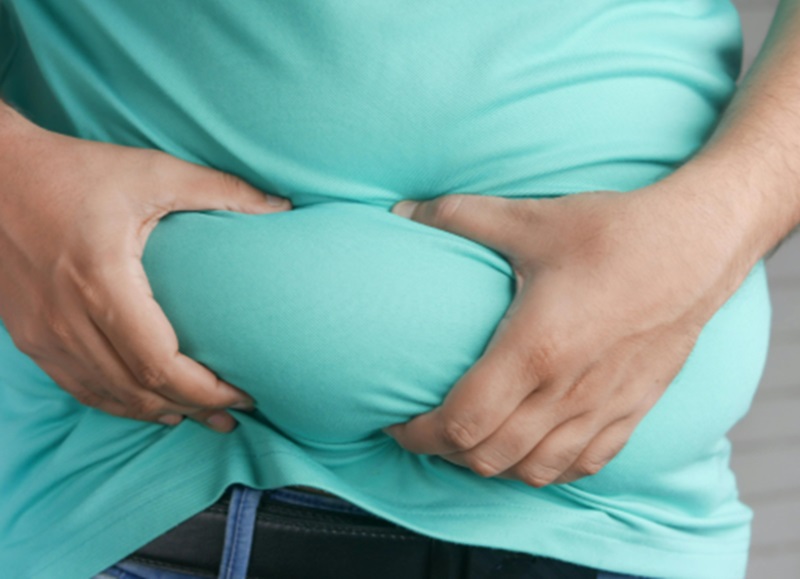 Obesitas mempercepat penuaan (Foto/Pexels)