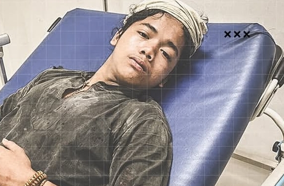 SPemuda suku Baduy jadi korban pembegalan di kawasan Cempaka Putih, Jakarta Pusat. (Foto/doc. Humas Polri)