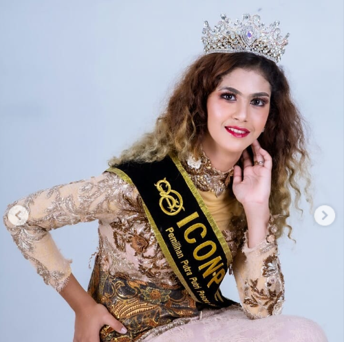 Profil Helwa Bachmid, model yang dinikahi Habib Bahar Smith dengan mahar cincin 2 gram. (Foto/Instagram Helwa Bachmid)