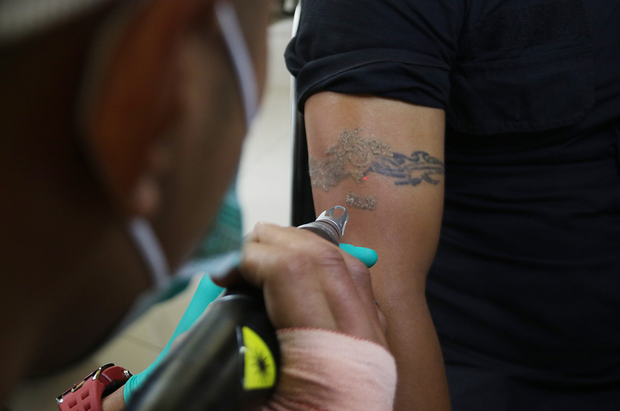 Petugas medis menghapus tato peserta menggunakan laser di Masjid Sunda Kelapa, Jakarta, Selasa(24/2/2026).  (Beritanasional.com/Oke Atmaja)