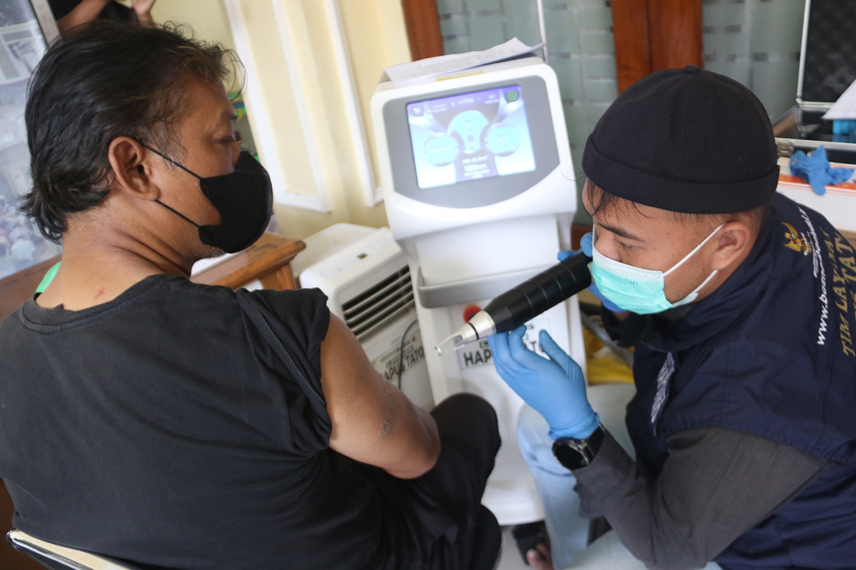 Petugas medis menghapus tato peserta menggunakan laser di Masjid Sunda Kelapa, Jakarta, Selasa(24/2/2026).  (Beritanasional.com/Oke Atmaja)