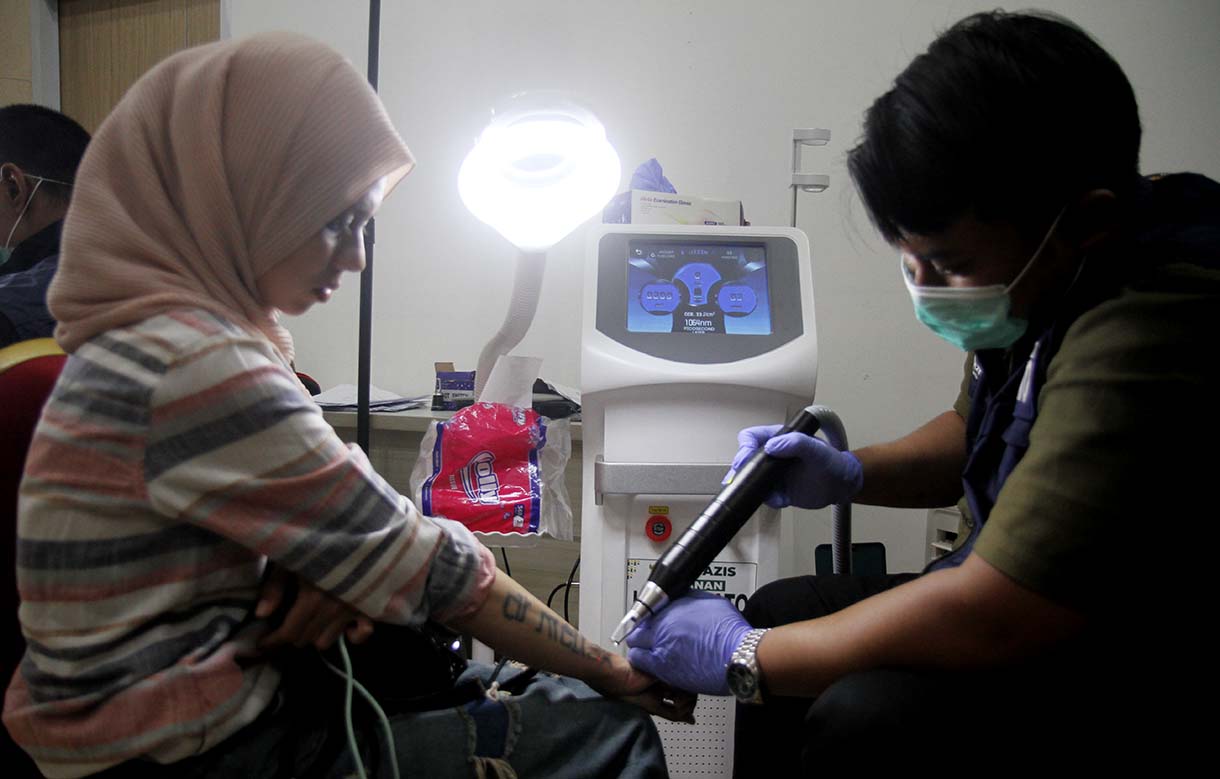 Petugas menghapus tato peserta menggunakan laser di Balai Kota DKI Jakarta, Senin (10/3/2025).  (Beritanasional.com/Oke Atmaja)